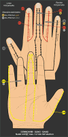 H - DÜNNDARM-SUNG-BANG